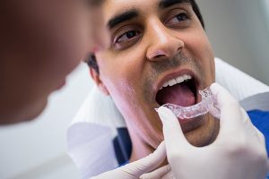 ortodontista invisalign aparelhos ortodonticos rj
