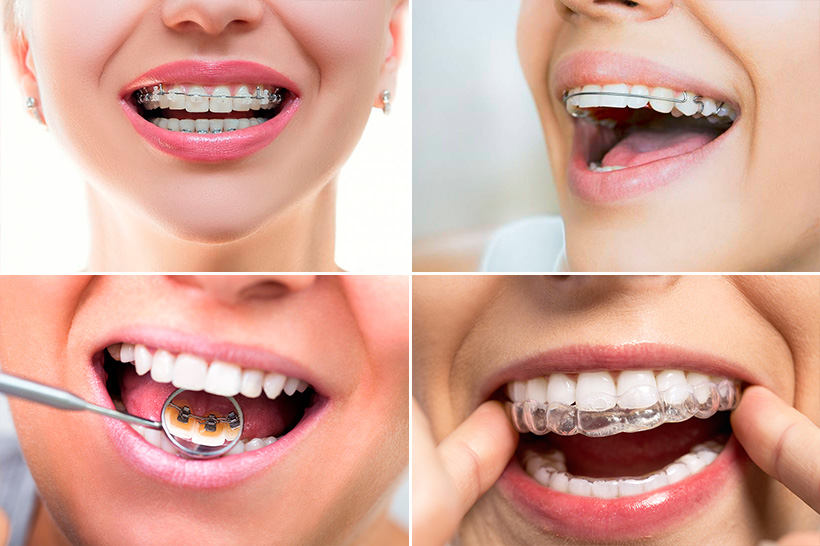 Tudo o que você precisa saber sobre Harmonização Facial - Clínica  Odontológica Oral 360 - Dentista Nova Iguaçu, Tijuca, Copacabana